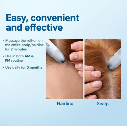 Advanced Hair Growth Roll-on Serum