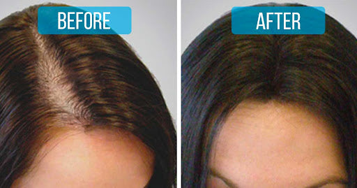 Advanced Hair Growth Roll-on Serum